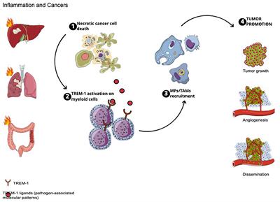 Triggering Receptors Expressed on Myeloid Cells 1 : Our New Partner in Human Oncology?